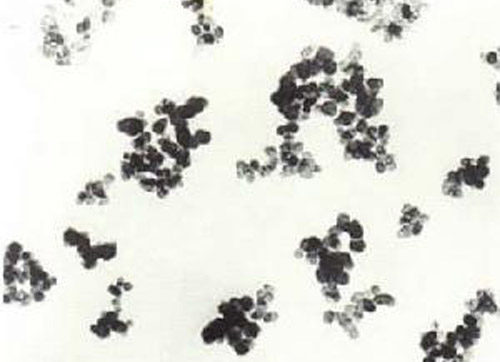 �ӹ���ɵğ�ⷨ̿�ڽY(ji��)��(g��u)�D